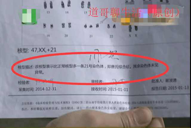 24个月还不会说话,女儿成了唐宝宝,医院:我们