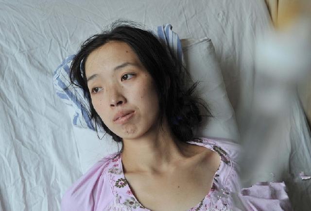 30岁女公务员肠癌去世不抽烟喝酒医生一个坏习惯
