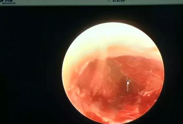 这层膜很薄,不小心就弄破了