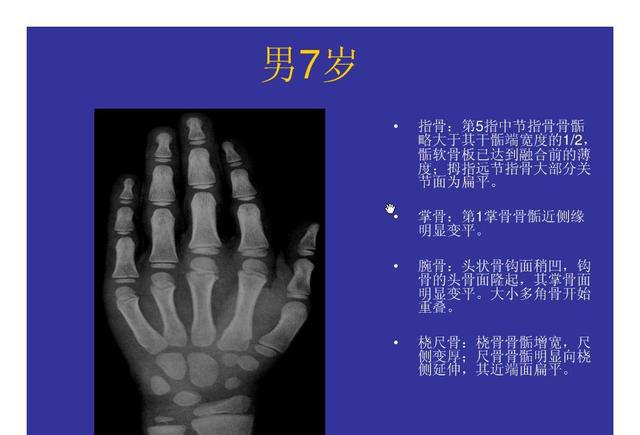 想知道孩子能长多高吗骨科干货儿童骨龄检测对照表