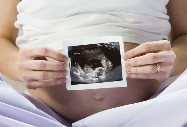 怀孕8周肚子图片图片