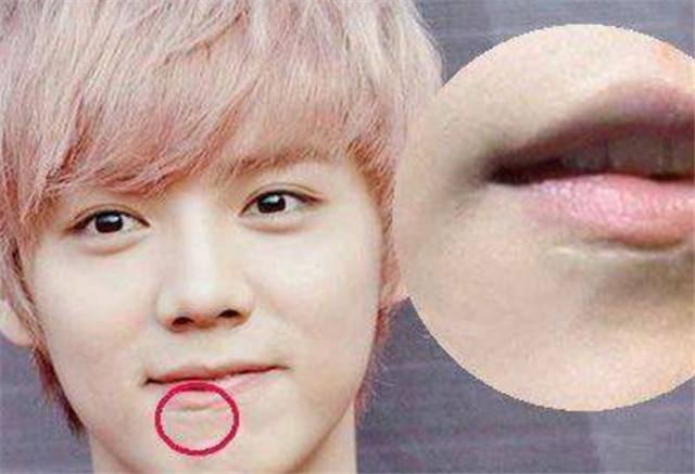 曾破相的3位明星,今一个个看不出来,且身价过亿,百万豪车出行