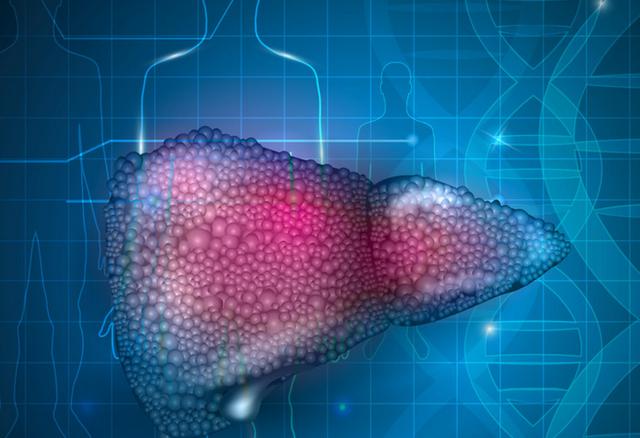 关于肝脏的硬度,我们可以用脸上的三个点来形象说明: 正常的肝脏摸