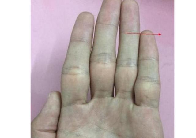 "小指过三关,不愁吃和穿",不管男女,一辈子必定富贵无比!