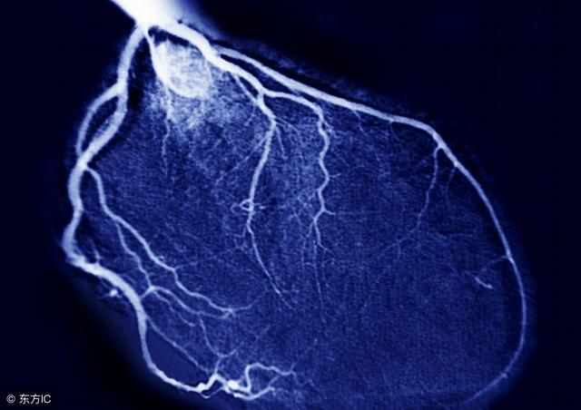 是将受检部位没有注入造影剂和注入造影剂后的血管造影x线荧光图像