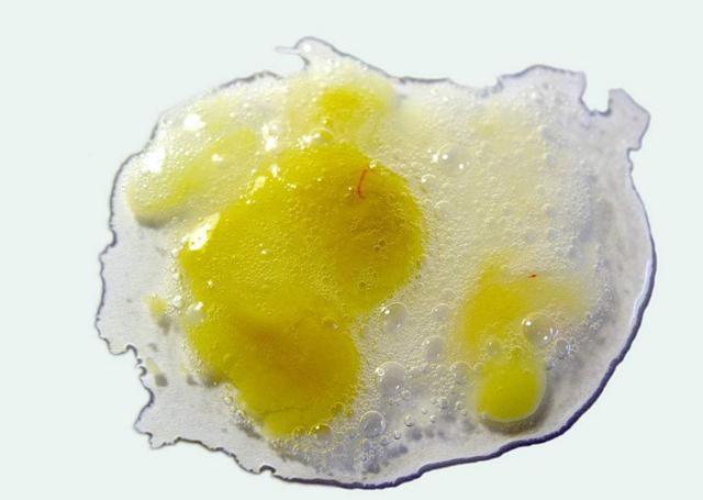 慢性咽炎|细菌|黏液_新浪新闻