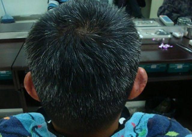 肾好不好,看白发长的位置就知道,男女都适用!