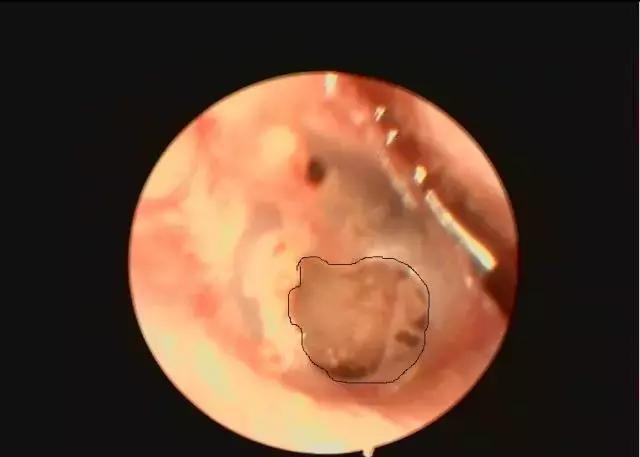 这层膜很薄不小心就弄破了