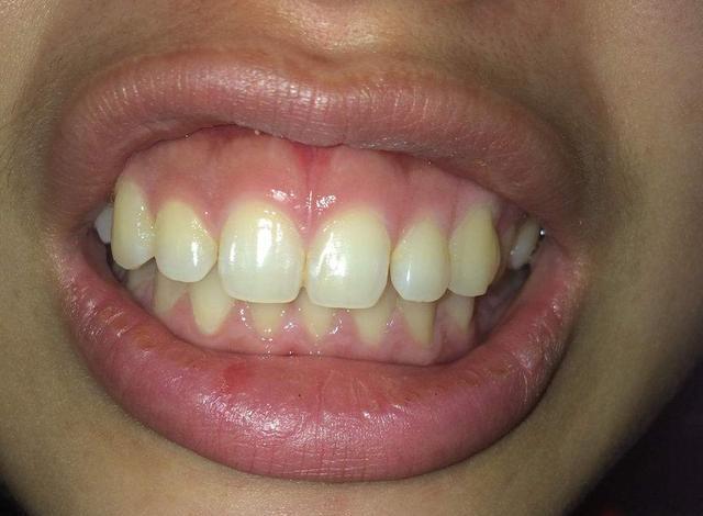 10.长有一口爆牙和吹火嘴的面相