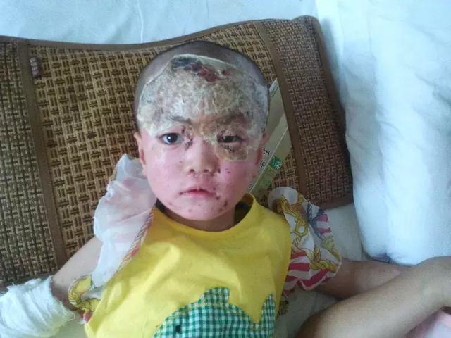 宝妈去打麻将留宝宝独自在家回来之后发现宝宝毁容了