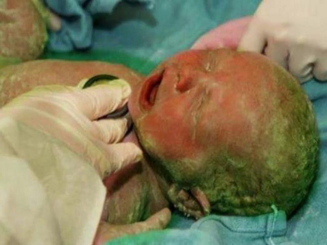 孕产期超一周去医院,医生剖开肚子瞬间懵了,孩子竟然这模样,咋了!