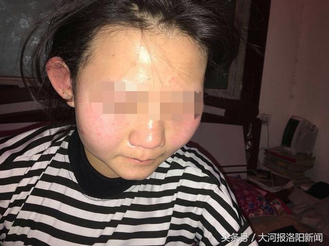 洛阳15岁女孩半夜遭多名女生掌掴,殴打,打人者在宿舍饮酒!