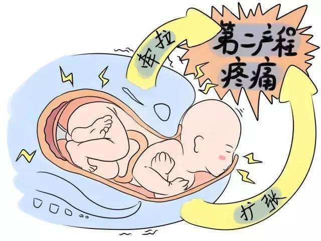医生给的孕妇分娩指南「孕妈妈一定要收藏」