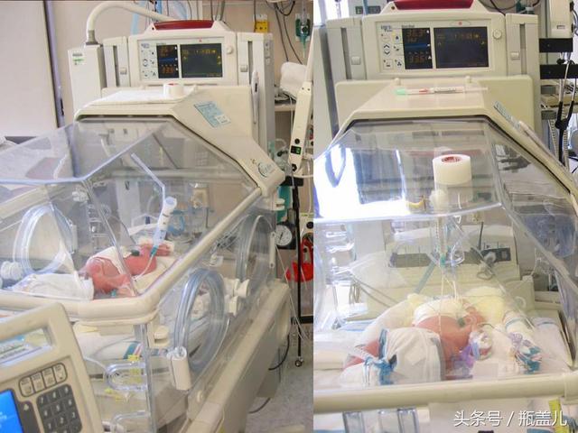 32周,晚上和老公还在摸着肚子和双胞胎哥哥弟弟宝宝说,爸爸妈妈明天和