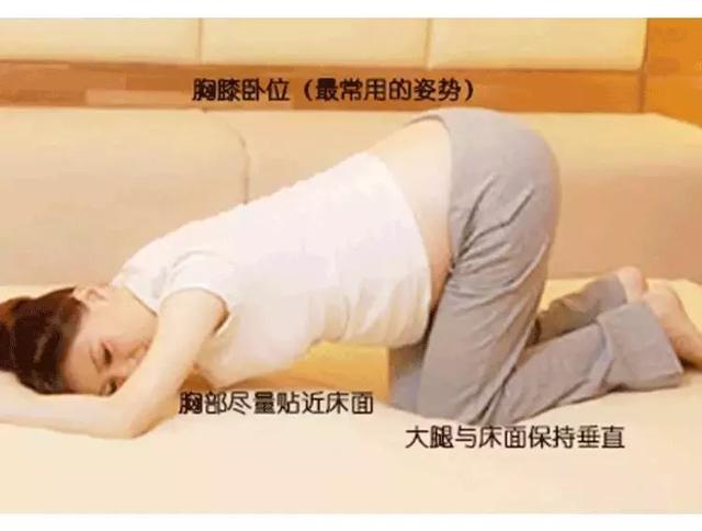 胎位不正太揪心一旦发现就要这么做