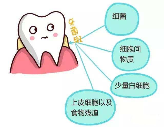 牙菌斑好烦人怎么去除它