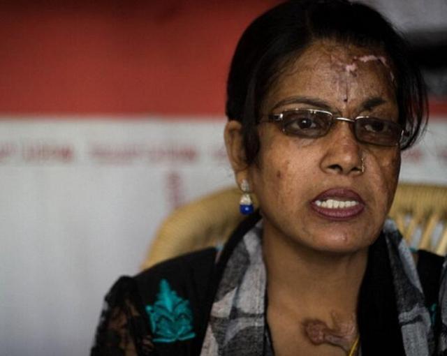 女孩17岁时因拒绝求婚, 被32岁男子泼硫酸毁容, 看了让人唏嘘不已