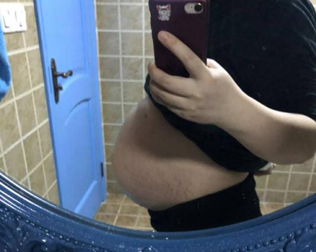 妊娠线图片男孩肚子图片