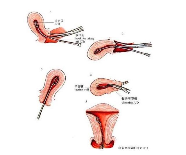 生完孩子后有件事比养孩还苦,看过的妈妈都哭了,女孩们都要了解