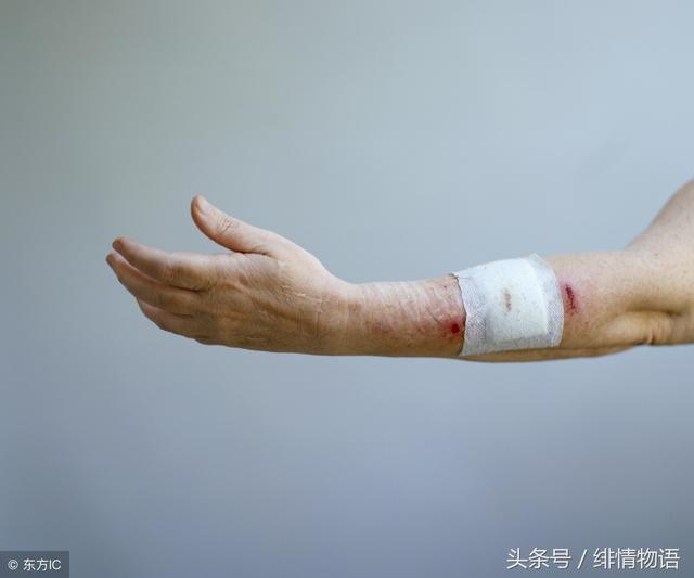 不许老公去见前女友她竟然自残难道我该放弃然后成全他们