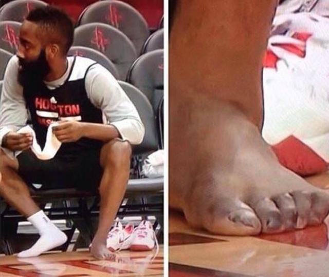 nba成为球星有多难?看了双詹的脚 乔科的手,你就知道