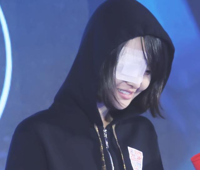 郑爽纱布遮眼让人想到绫波丽调侃自己不乖的时候十头驴都拦不住