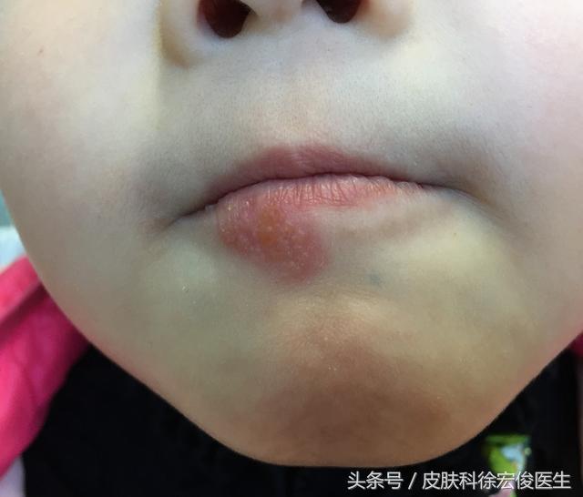 不要让别人喂宝宝坚果,不要给宝宝喝酒,不要随意亲吻宝宝!