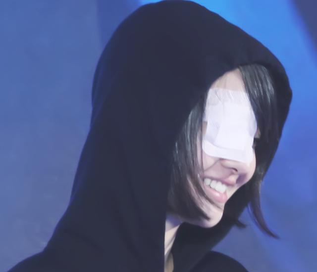 郑爽纱布遮眼让人想到绫波丽调侃自己不乖的时候十头驴都拦不住