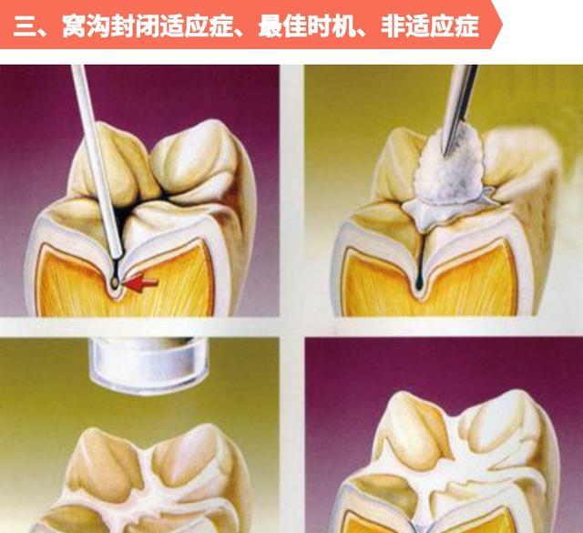 爸妈应该知道这几件事!