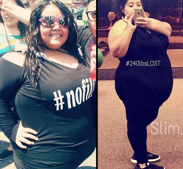 400斤女孩胖到无法站立,3年甩肉260斤,美的连妈都不认识了