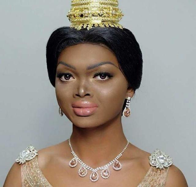 她因外表"被社会霸凌" 凭自信改变命运 现在进军国际当超模