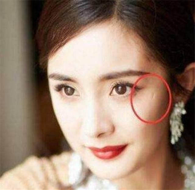 曾破相的3位明星, 今一个个看不出来, 且身价过亿, 百万豪车出行