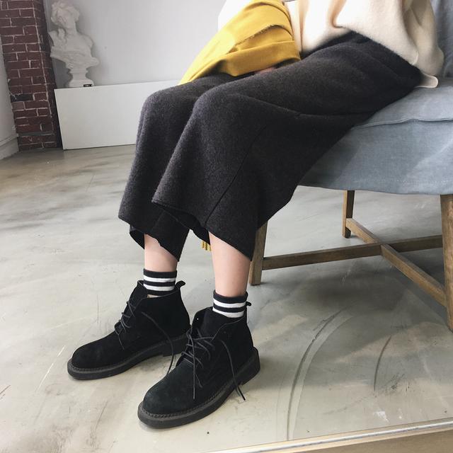 冬天露脚踝真的好吗?姑娘们别再傻了