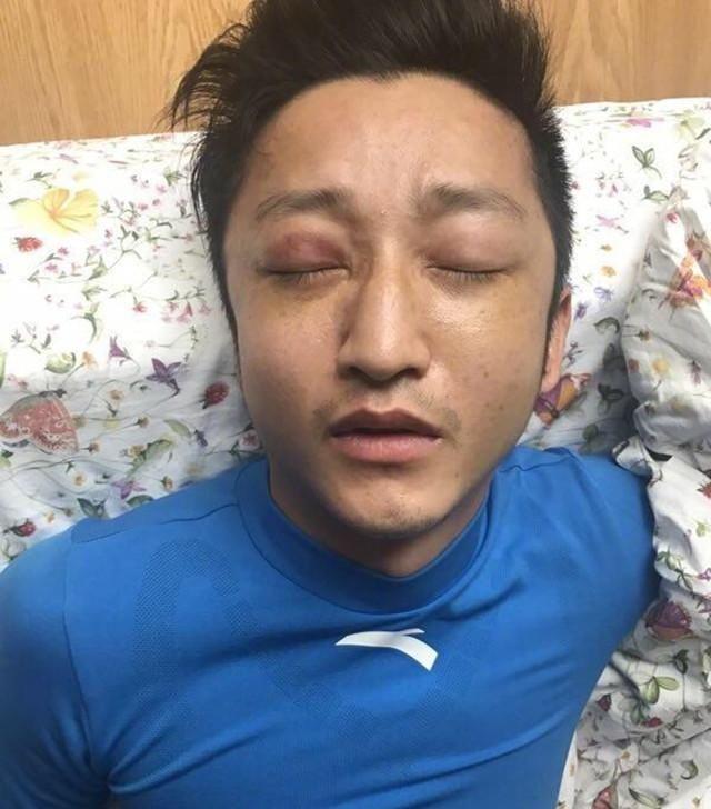邹市明入院治疗眼伤期待重返拳台,玩跳一跳最高68分
