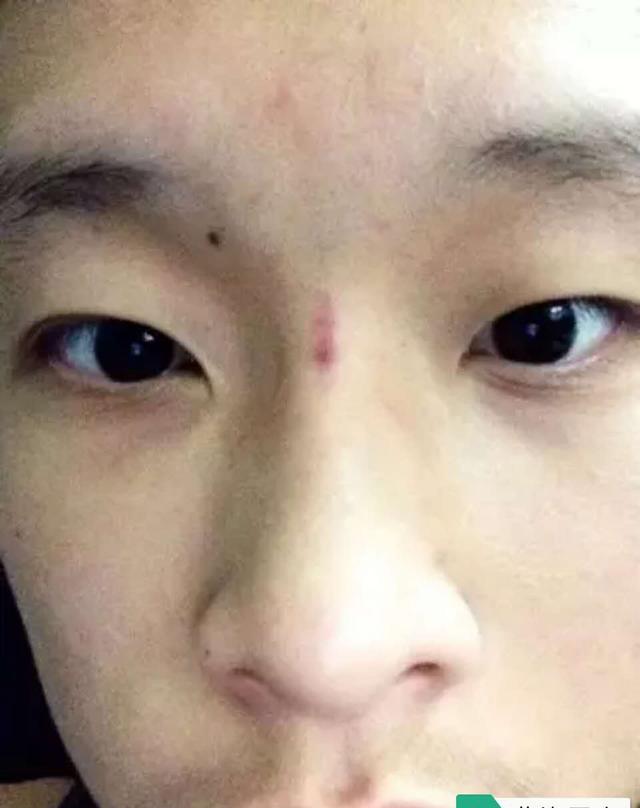 论疾厄宫面相学