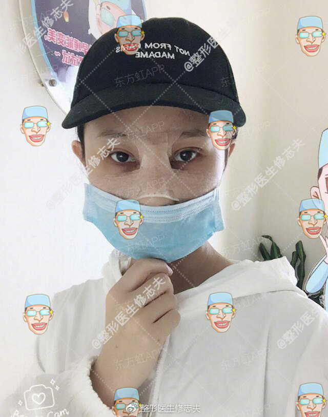 歪鼻修复术后40天恢复日记:从沮丧煎熬到欣喜