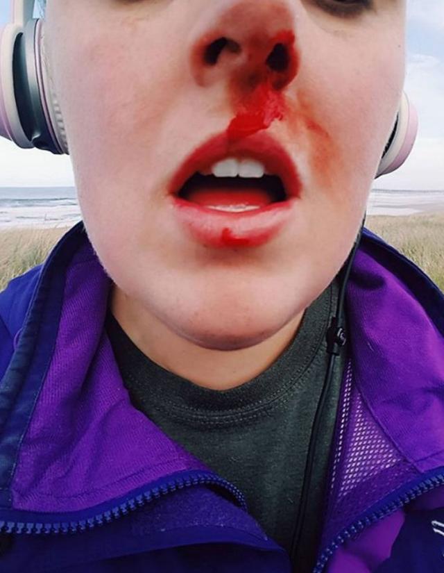 女子去营救小动物小混混看不过去将她打出鼻血