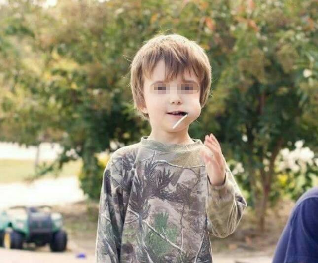 2岁宝宝舌苔厚重,医生询问了宝宝的食谱才知道