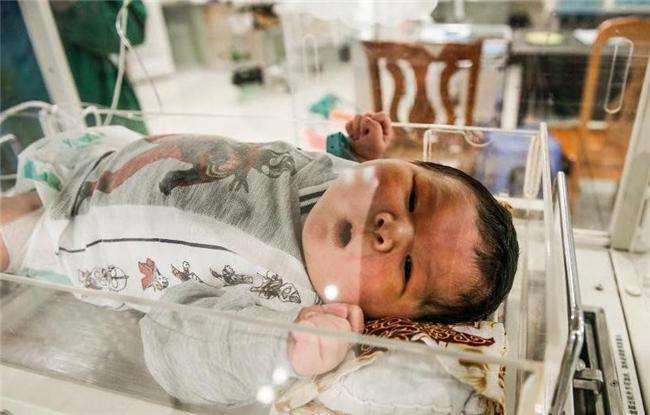 医院的婴儿床都是按照标准婴儿设计的,这位宝宝经常撞到头,只要一哭闹