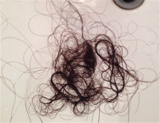 掉头发是女生,和父母最讨厌的问题,每次清理的时候地上一抓一大把又