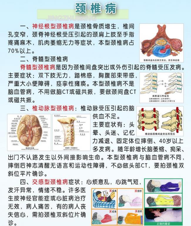 颈椎病是由于颈部椎体及其相邻组织的退变,增生导致.