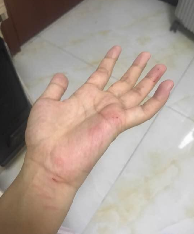 泰迪咬主人屡教不改网友替他想出这个办法绝了