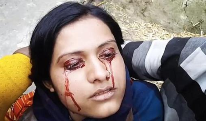 你有可能哭出来的不仅仅眼泪还有血?|眼泪|血症|血泪_新浪新闻