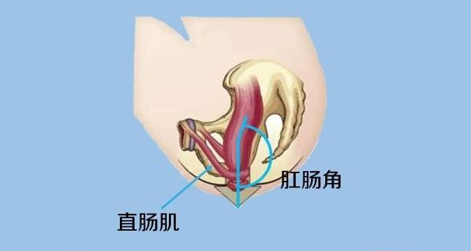 我们人体有一根u形耻骨直肠肌,它从一侧耻骨出发,绕直肠连接到另一侧