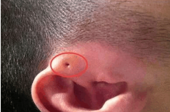 如果有宝妈们要注意了