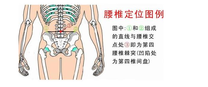 腰间盘突出只用药店一味小小的药,每天坚持下去,不出7天痊愈!