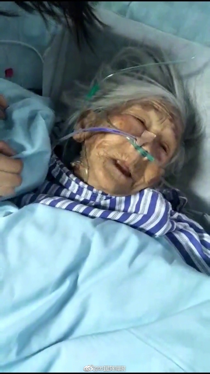 转发扩散!纪录片《二十二》韦绍兰老人病危!手术后急需志愿者照顾!