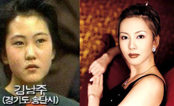 金南珠整容前后对比照曝光, 整得十分成功, 帅气老公将其宠上天