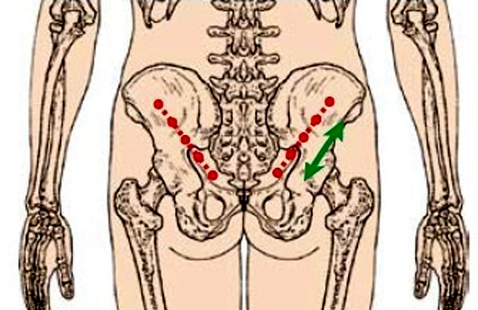 别再被坑了!这三个民间方法一周可明显缓解腰椎间盘突出!