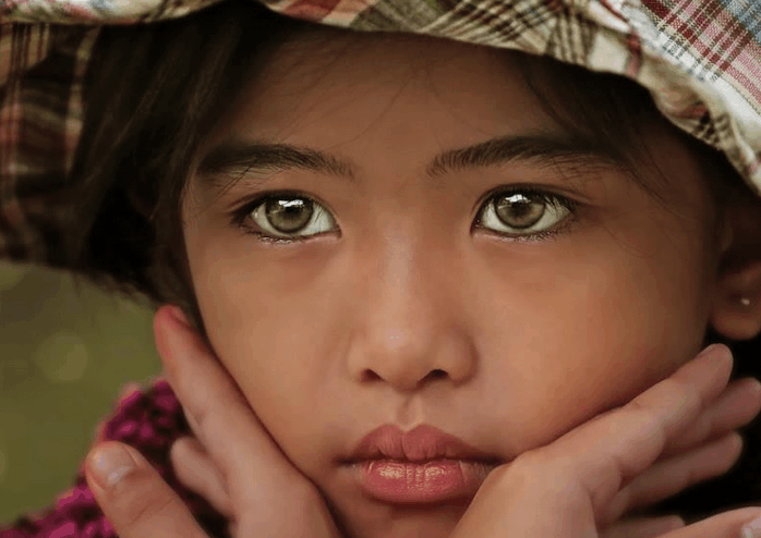 一个普通的小女孩, 因为一双眼睛, 全世界都认识了她